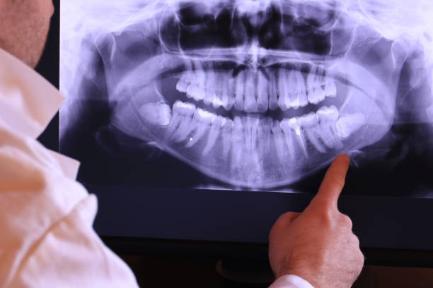 Best Holiday Emergency Dentist in Garden Grove, FL